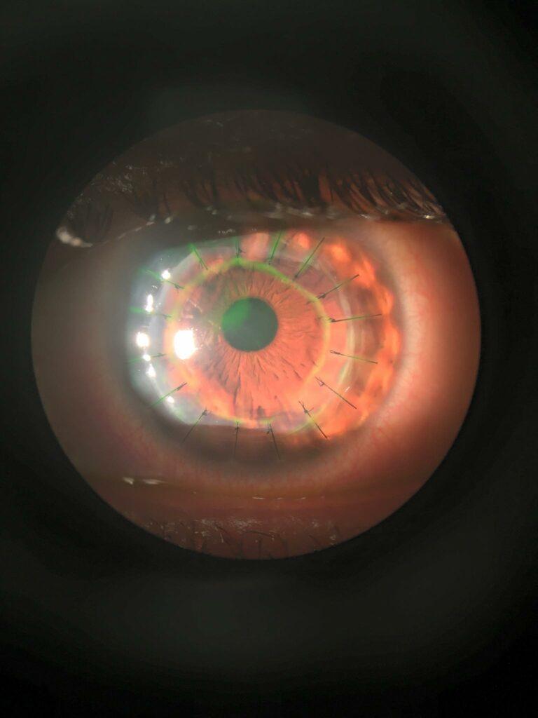 A close up of an eye