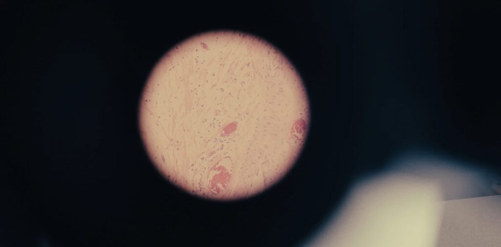 A tissue sample seen through a microscope