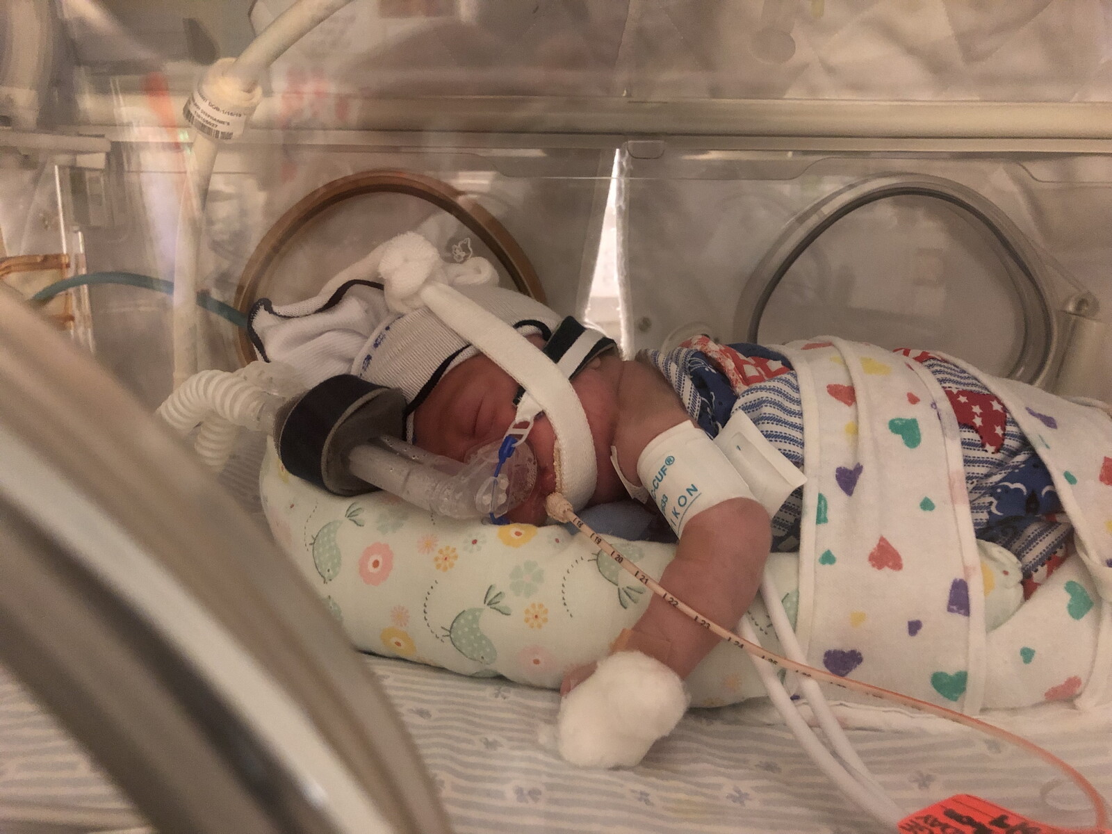 Zev Hauser in the NICU